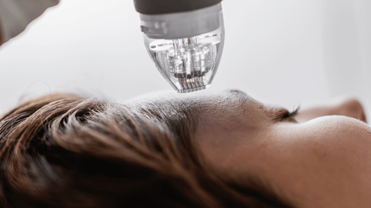 Microneedling-behandling i ansiktet med dermapen som stimulerar kollagenproduktion och förbättrar hudens struktur